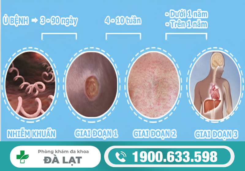 BỆNH LẬU – NHỮNG ĐIỀU BẠN CẦN BIẾT ĐỂ PHÒNG VÀ CHỮA KỊP THỜI